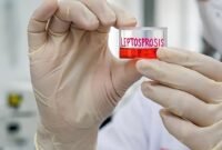 Waspadai Leptospirosis